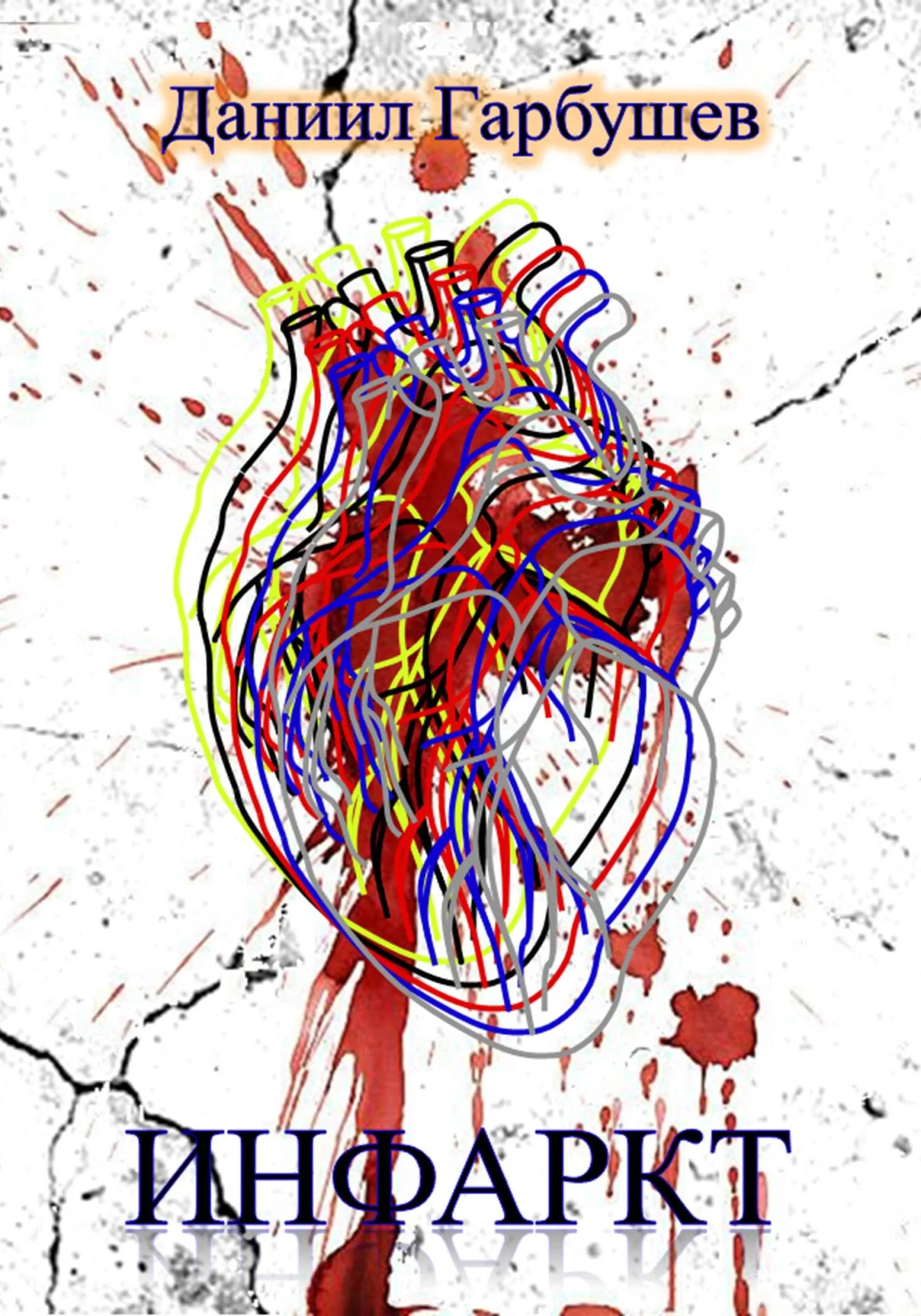 Обложка Инфаркт