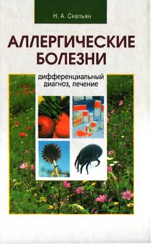 Обложка Аллергические болезни: дифференциальный диагноз, лечение