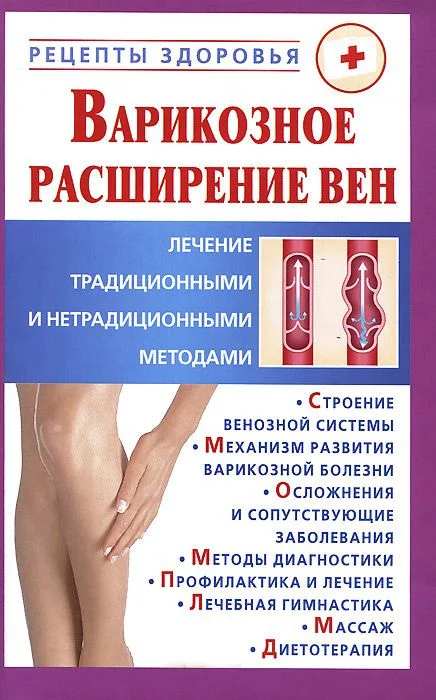 Обложка Варикозное расширение вен.