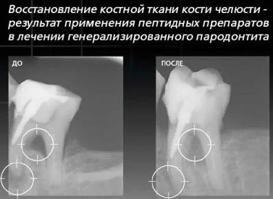 Обложка Как я вырастил новые зубы