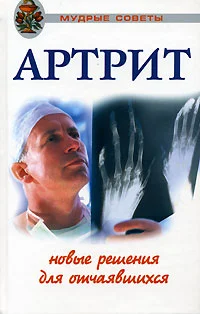 Обложка Артриты. Травы, которые помогут избежать операции